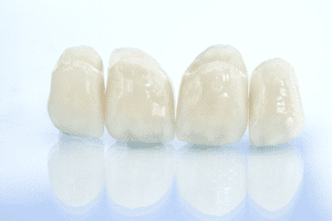 Dental Crowns Dental Crown Nautical Dental and Braces, 17147 Autry Pond Rd. Suite 104 San Antonio TX 78247, Dr. Eric D. Cornelius DDS, Dentist in San Antonio Texas, Uptown San Antonio Dentist Braces, Orthodontist, Family Dentist, Cosmetic Dentistry, Emergency Dentistry, General Dentistry, Dental Implants, Restorative Dentistry, Sedation Dentistry Composite Fillings, Dental Bridges, Bridge, Porcelain Veneers, Veneer, Tooth-Colored Fillings, Filling, Braces, Invisalign, Clear Aligners, Composite Fillings, Teeth Whitening, Full Mouth Reconstruction, All on 5 Dental Implants, Partial Dentures, Full Denture, Dentures, Implant Supported Dentures, Sedation Dentistry, Family Dentistry, Local San Antonio Texas Dentist, Orthodontist San Antonio